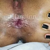 Alfaquinn голая #0001