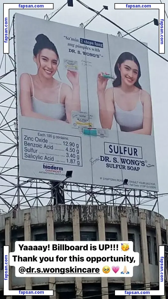 Analyn Barro голая фото #0006 с Онлифанс