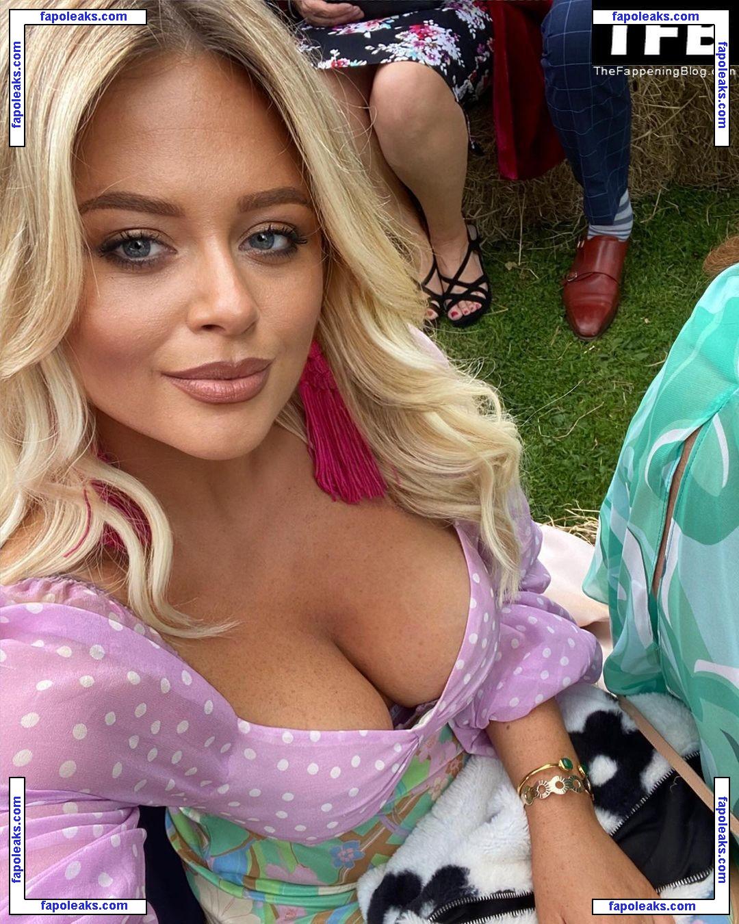 Emily Atack / emilyatack nude photo #0601 from OnlyFans