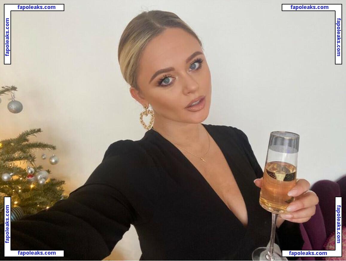 Emily Atack / emilyatack nude photo #0786 from OnlyFans