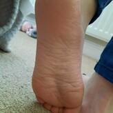 homefortoes nude #0013