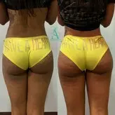 Lia Aesthetic nude #0018