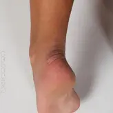 Scandinavian Feet голая #0195