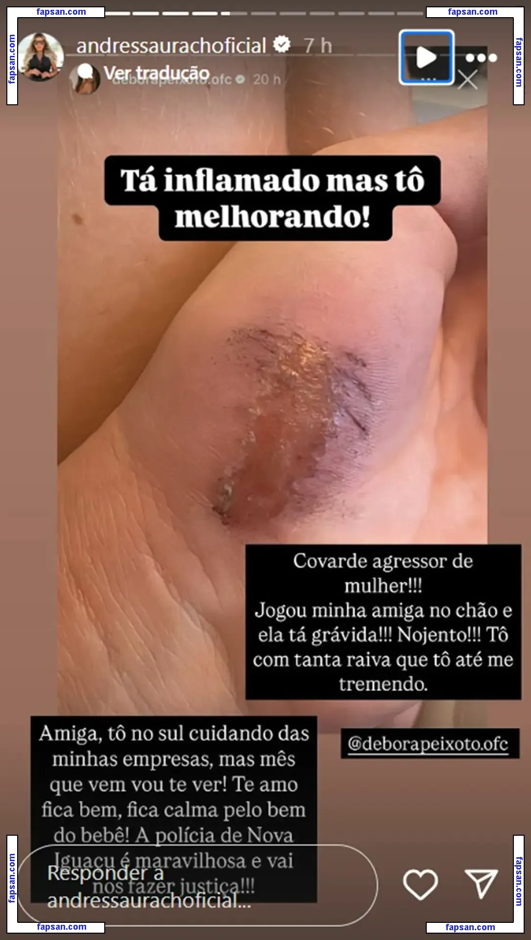 Tretas nude photo #0014 from OnlyFans