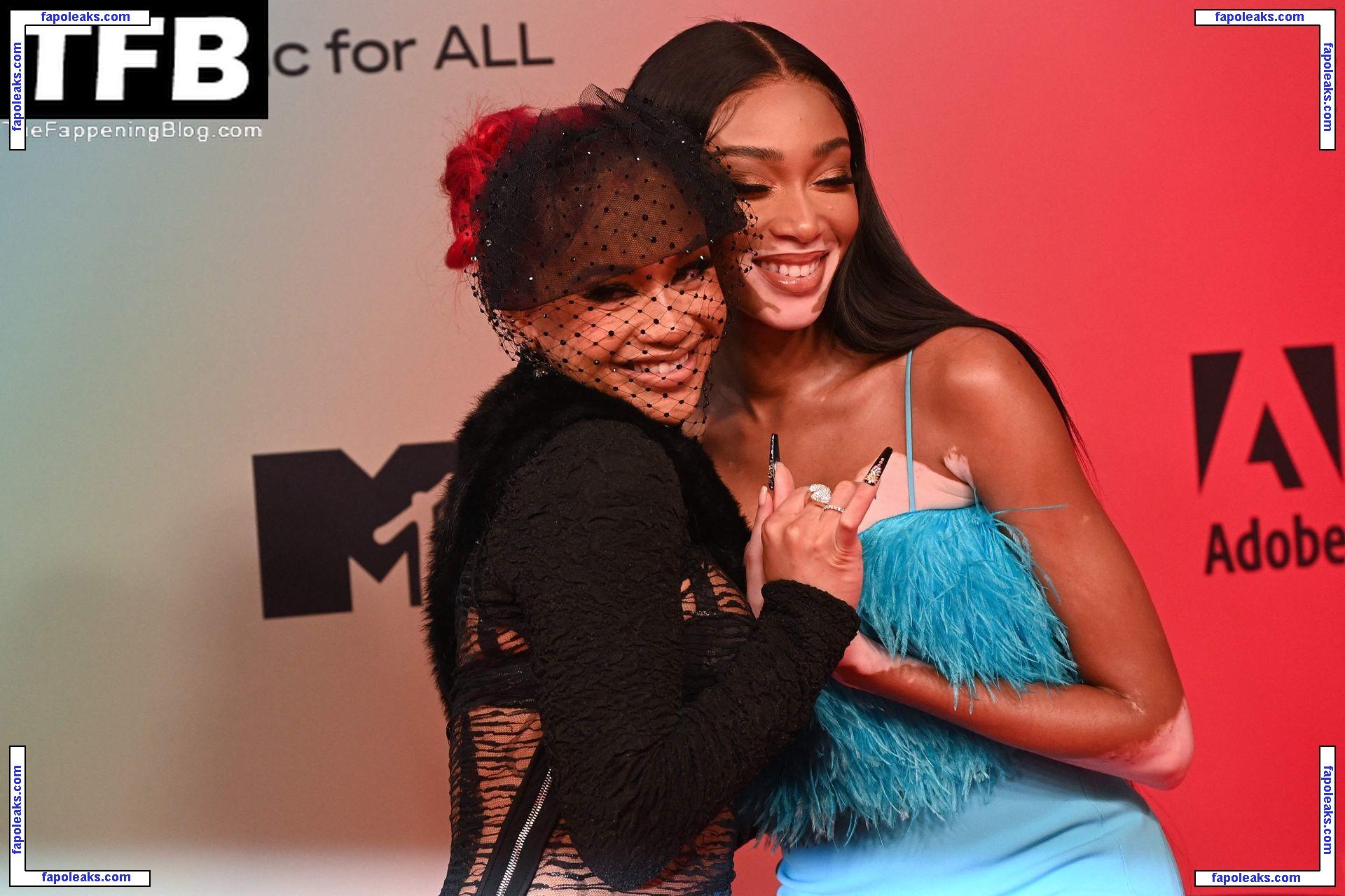 Winnie Harlow / winnieharlow nude photo #0376 from OnlyFans