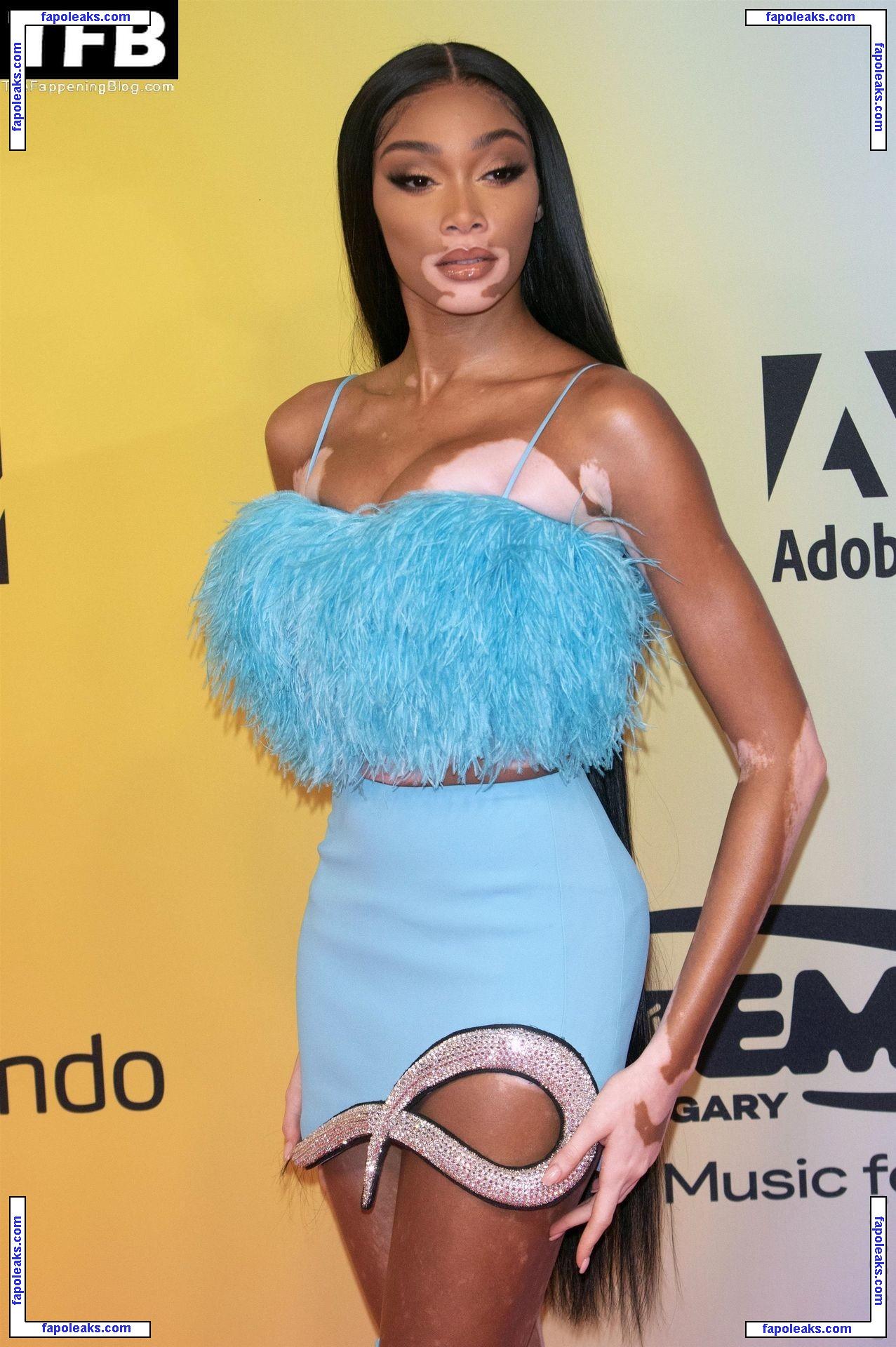 Winnie Harlow / winnieharlow nude photo #0414 from OnlyFans