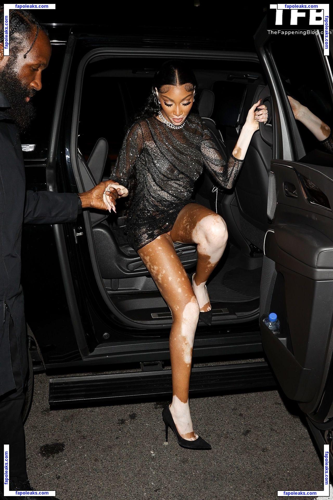 Winnie Harlow / winnieharlow nude photo #0640 from OnlyFans