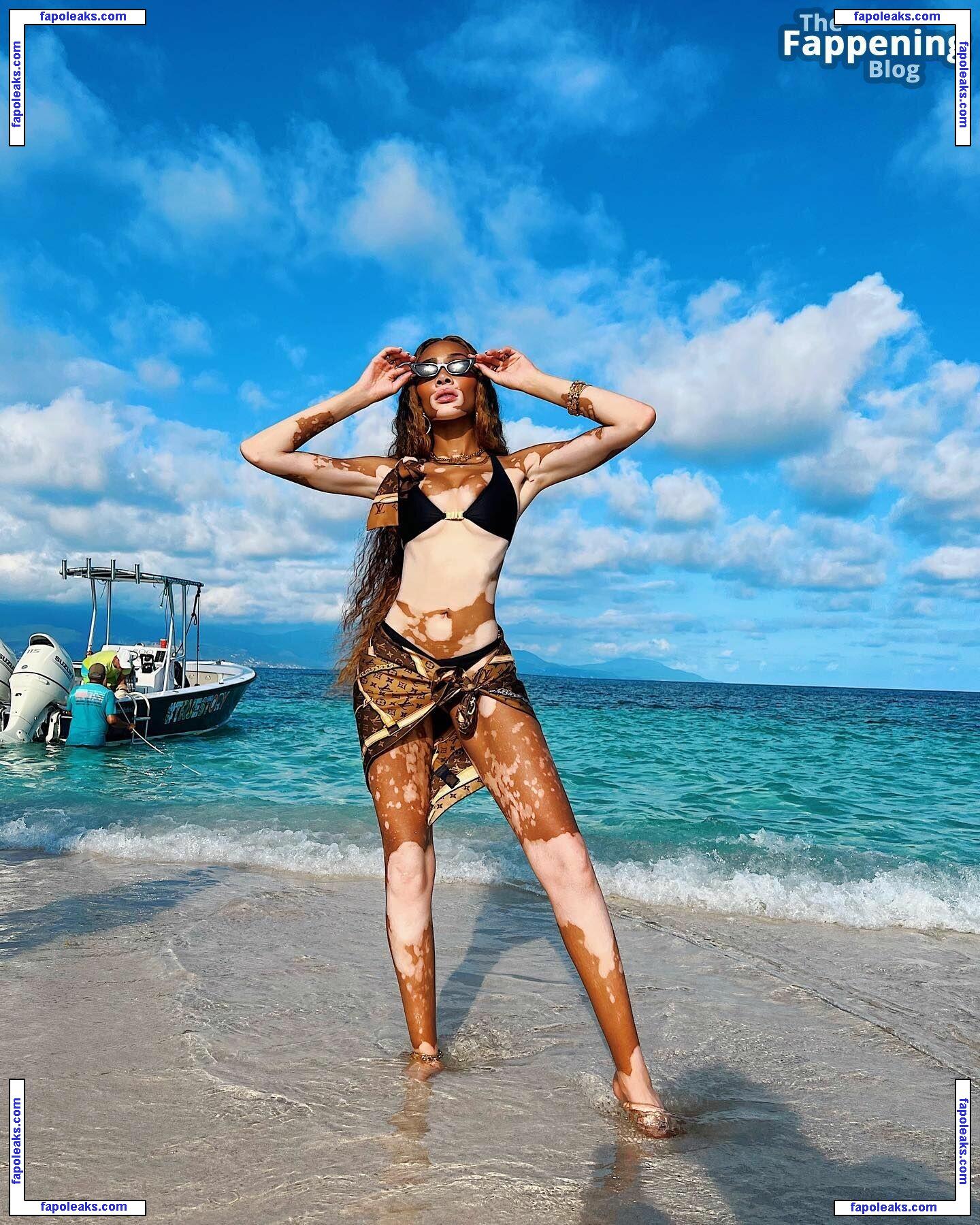 Winnie Harlow / winnieharlow nude photo #0908 from OnlyFans