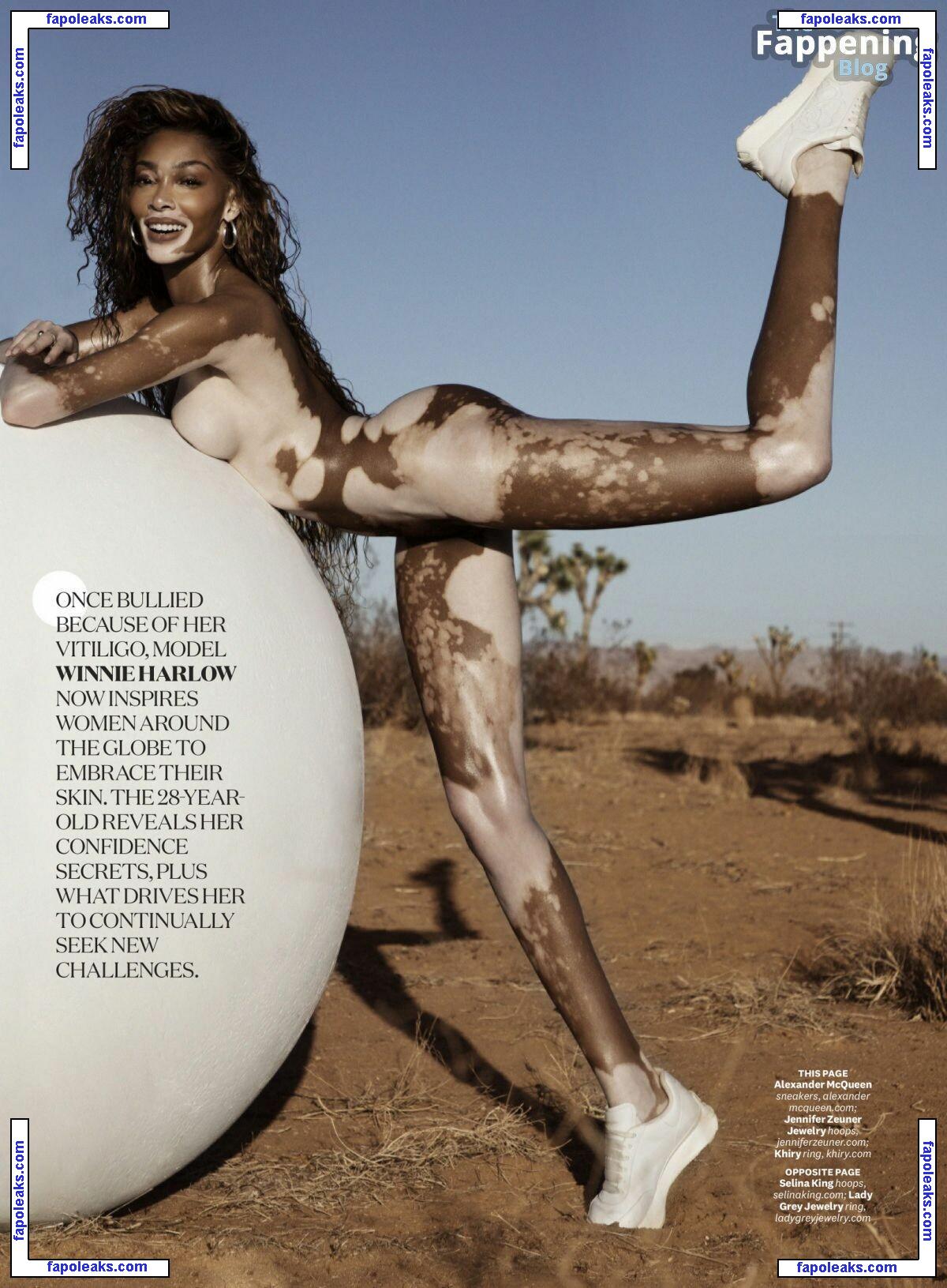 Winnie Harlow / winnieharlow nude photo #0914 from OnlyFans