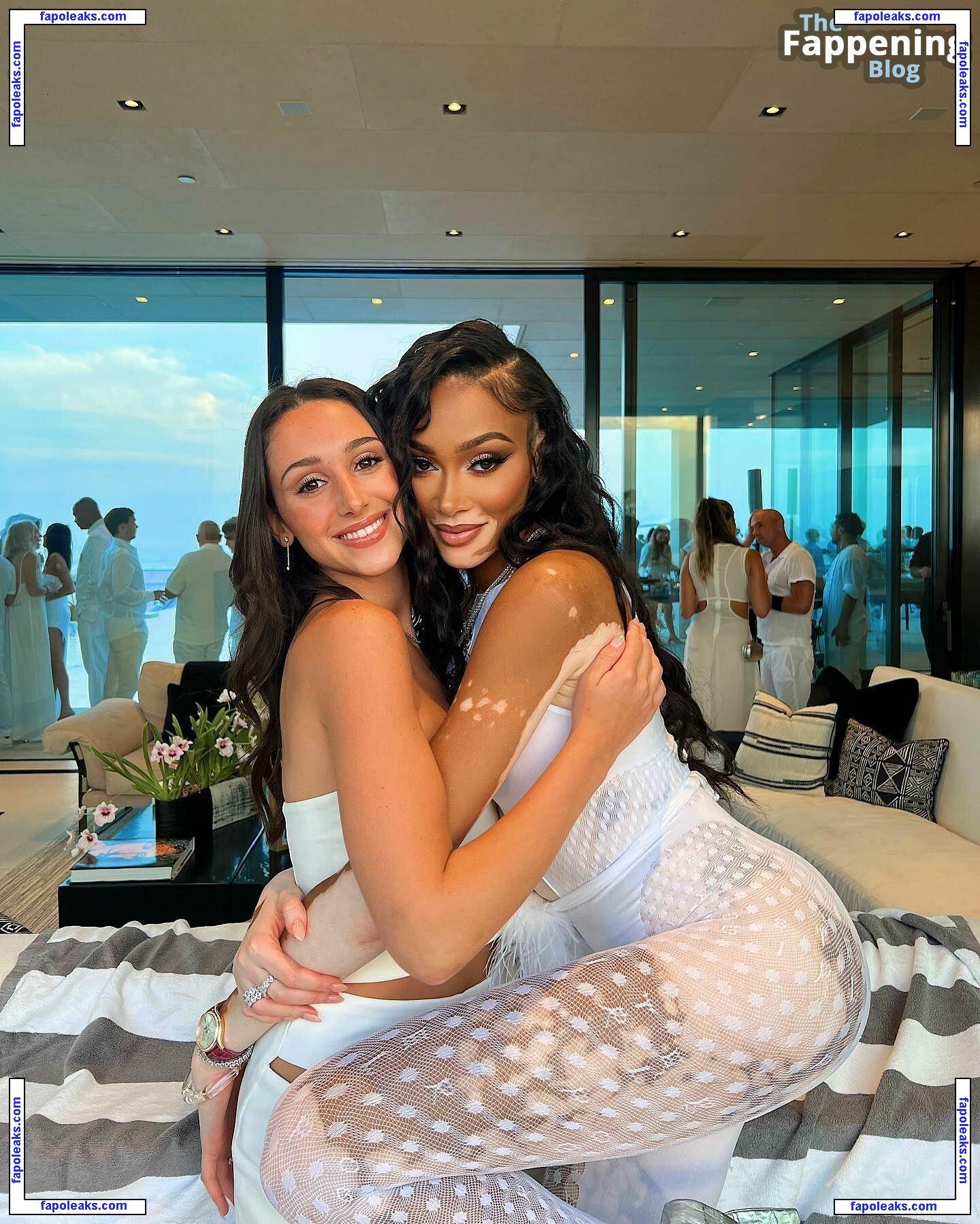 Winnie Harlow / winnieharlow голая фото #0924 с Онлифанс