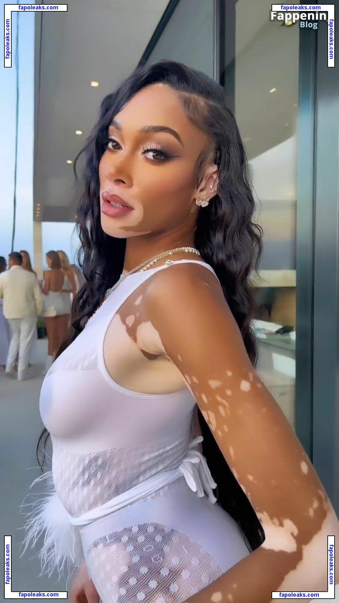 Winnie Harlow / winnieharlow nude photo #0944 from OnlyFans