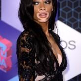 Winnie Harlow nude #0002