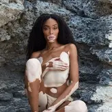 Winnie Harlow голая #0008