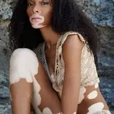 Winnie Harlow голая #0012