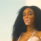 Winnie Harlow голая #0058