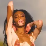 Winnie Harlow голая #0059