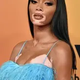 Winnie Harlow голая #0416