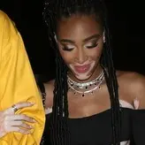 Winnie Harlow голая #0871