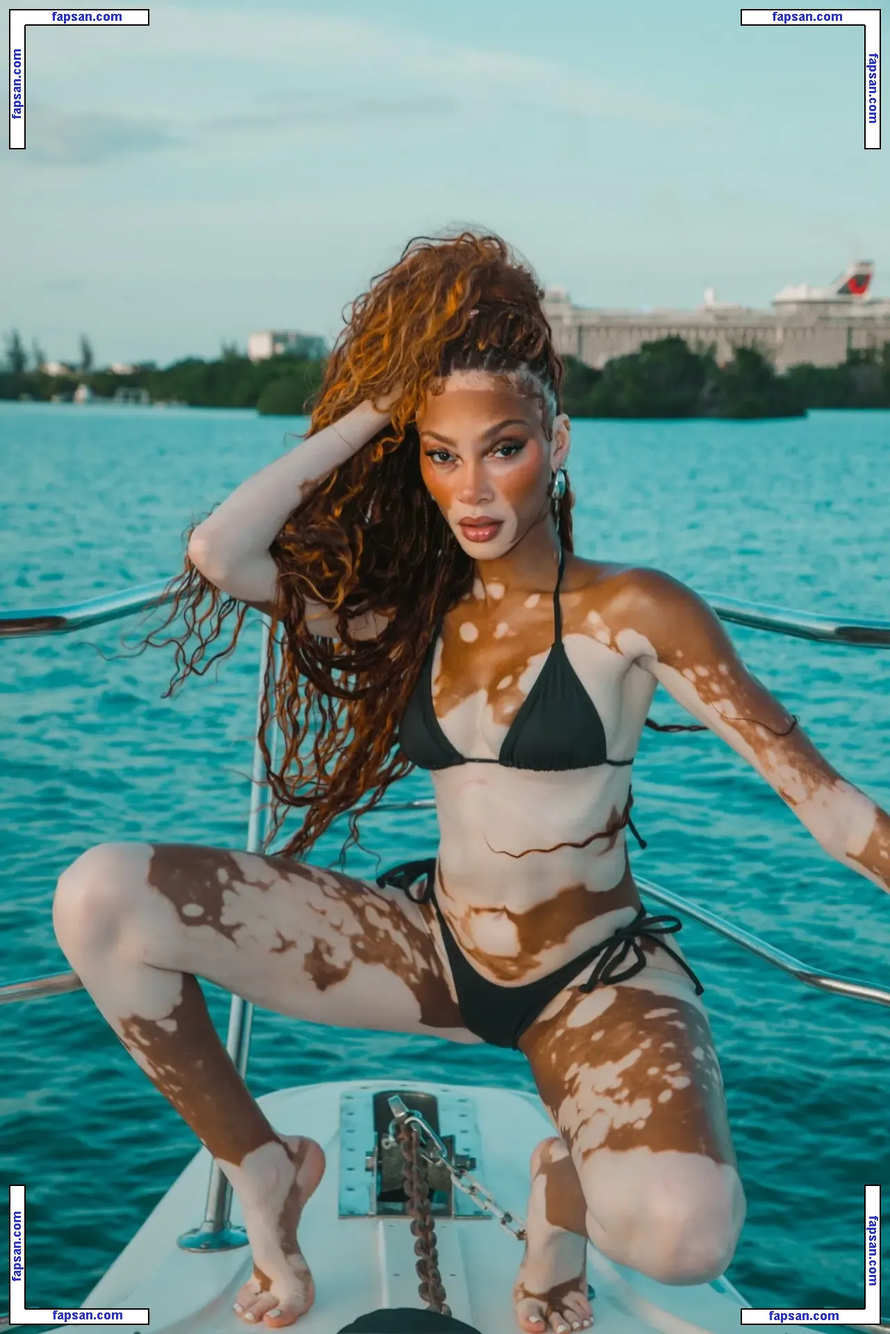 Winnie Harlow nude photo #1187 from OnlyFans