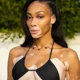 Winnie Harlow голая #1019