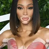 Winnie Harlow голая #1109