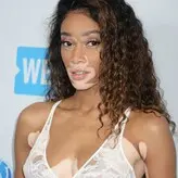 Winnie Harlow голая #1154