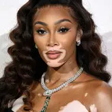 Winnie Harlow голая #1158