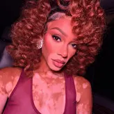 Winnie Harlow nude #1197